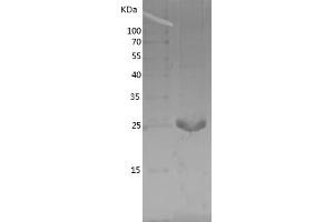 Western Blotting (WB) image for Aprataxin (APTX) (AA 180-356) protein (His tag) (ABIN7121877)