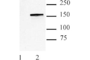 Cas9 antibody (mAb) tested by Western blot. (CRISPR-Cas9 (N-Term) anticorps)