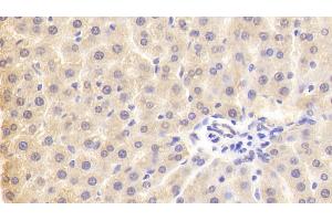 Detection of PLA2G3 in Rat Liver Tissue using Polyclonal Antibody to Phospholipase A2, Group III (PLA2G3)