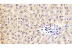 Detection of PLA2G3 in Rat Liver Tissue using Polyclonal Antibody to Phospholipase A2, Group III (PLA2G3) (PLA2G3 anticorps  (AA 20-268))