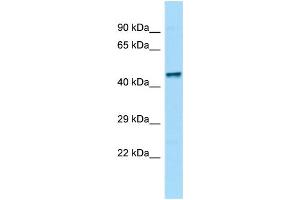 WB Suggested Anti-Zfp69 Antibody Titration: 1.
