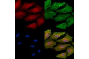 ABIN6261603 and ABIN6272958 staining  cells by IF/ICC.