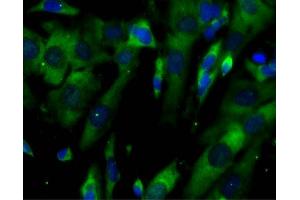 Immunofluorescent staining of SH-SY5Y cells (right).