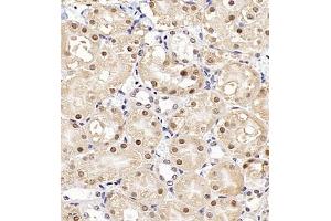 Immunohistochemistry of paraffin embedded mouse kidney using UBE3A (ABIN7076105) at dilution of 1:500 (400x lens)