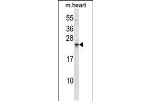 Western blot analysis in mouse heart tissue lysates (35ug/lane). (SOSTDC1 anticorps  (C-Term))