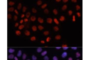 Immunofluorescence analysis of HeLa cells using RCC1 Polyclonal Antibody at dilution of 1:100. (RCC1 anticorps)