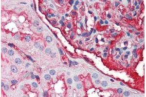 Human Kidney (formalin-fixed, paraffin-embedded) stained with EDA2R antibody ABIN214487 at 2. (Ectodysplasin A2 Receptor anticorps)