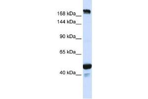 KIAA1618 antibody used at 0.