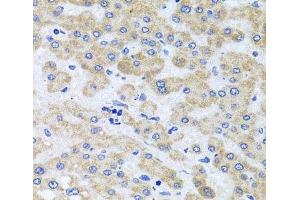Immunohistochemistry of paraffin-embedded Human liver damage using PEX3 Polyclonal Antibody at dilution of 1:100 (40x lens). (PEX3 anticorps)