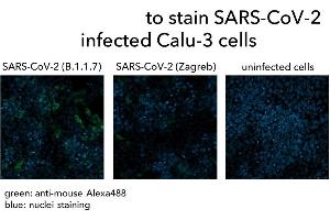 Calu-3 cells were infected with SARS-CoV-2 (B.