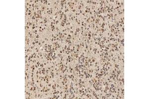 IHC analysis of SNRNP40 using anti-SNRNP40 antibody (ABIN7601719). (SNRNP40 anticorps  (AA 43-357))