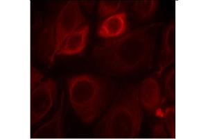 Image no. 1 for anti-Receptor Tyrosine-Protein Kinase ErbB-3 (ERBB3) (pTyr1328) antibody (ABIN319274) (ERBB3 anticorps  (pTyr1328))