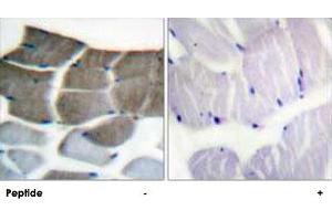 Immunohistochemistry analysis of paraffin-embedded human skeletal muscle tissue using ACACA polyclonal antibody . (Acetyl-CoA Carboxylase alpha anticorps  (Ser79))