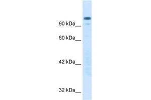 WB Suggested Anti-GTF2I Antibody Titration:  0. (GTF2I anticorps  (N-Term))