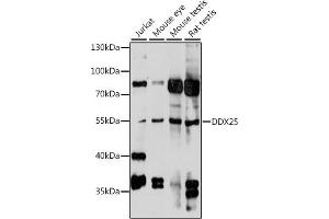 Western blot analysis of extracts of various cell lines, using DDX25 antibody (ABIN7266692) at 1:1000 dilution. (DDX25 anticorps  (AA 284-483))