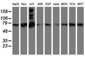 Image no. 2 for anti-SAM Domain and HD Domain 1 (SAMHD1) antibody (ABIN1500798) (SAMHD1 anticorps)
