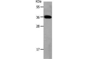 Gel: 10 % SDS-PAGE Lysates (from left to right): Mouse large intestine tissue Amount of lysate: 30 μg per lane Primary antibody: 1/800 dilution Secondary antibody dilution: 1/8000 Exposure time: 20 seconds (MC3R anticorps  (N-Term))