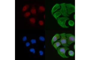 ABIN6264342 and ABIN6277090 staining Hela cells by IF/ICC.