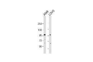 All lanes : Anti-EPS8 Antibody (N-term) at 1:2000 dilution Lane 1: A549 whole cell lysate Lane 2: LOVO whole cell lysate Lysates/proteins at 20 μg per lane. (EPS8 anticorps  (N-Term))
