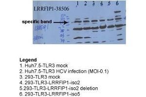 Sample Type: Hepatitis C Virus & 293 TransfectionsPrimary Dilution: 1ug/mL (LRRFIP1 anticorps  (N-Term))