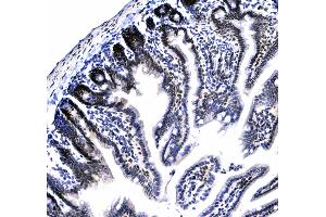 IHC analysis of HP1 gamma using anti-HP1 gamma antibody .