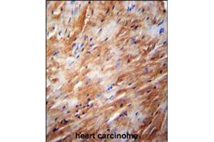 TFB2M Antibody immunohistochemistry analysis in formalin fixed and paraffin embedded human heart carcinoma followed by peroxidase conjugation of the secondary antibody and DAB staining. (TFB2M anticorps  (C-Term))
