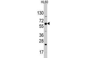 Western blot analysis of SLC2A2 polyclonal antibody  in HL-60 cell line lysates (35 ug/lane). (SLC2A2 anticorps  (N-Term))