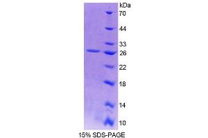 SDS-PAGE analysis of Human Sp17 Protein. (SPA17 Protéine)