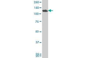 SMARCA5 polyclonal antibody (A01), Lot # 051018JC01 Western Blot analysis of SMARCA5 expression in Y-79 .