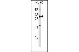 Western blot analysis of HOXB8 / HOX2D Antibody (C-term) in HL-60 cell line lysates (35ug/lane).