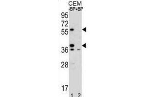 Western Blotting (WB) image for anti-Myeloid Cell Nuclear Differentiation Antigen (MNDA) antibody (ABIN2996101) (MNDA anticorps)