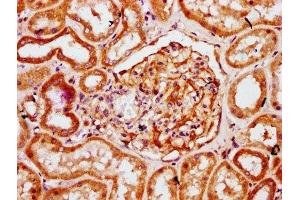 anti-4-Hydroxy-2-Oxoglutarate Aldolase 1 (HOGA1) (AA 1-164) antibody