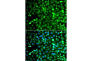 Immunofluorescence analysis of A549 cell using OSGEP antibody. (OSGEP anticorps)