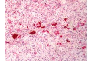 Human Adrenal: Formalin-Fixed, Paraffin-Embedded (FFPE)