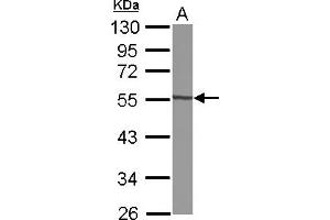 Western Blotting (WB) image for anti-Glycosyltransferase-Like Domain Containing 1 (GTDC1) (AA 1-204) antibody (ABIN1498561) (GTDC1 anticorps  (AA 1-204))