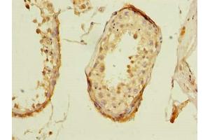 Immunohistochemistry of paraffin-embedded human testis tissue using ABIN7176433 at dilution of 1:100