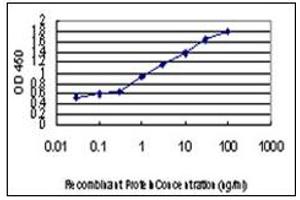 anti-Homeodomain Interacting Protein Kinase 2 (HIPK2) antibody