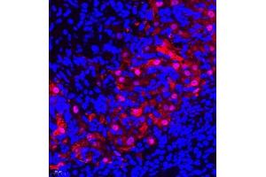 Immunofluorescence of paraffin embedded rat ovary using SLC7A8 (ABIN7074503) at dilution of 1:300 (400x lens)