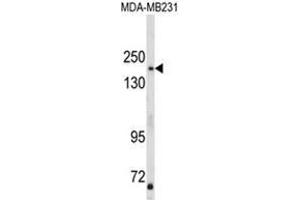 Western blot analysis of TBC1D4 Antibody (N-term) in MDA-MB231 cell line lysates (35ug/lane). (TBC1D4 anticorps  (N-Term))