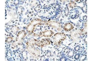 PPP1R8 antibody was used for immunohistochemistry at a concentration of 4-8 ug/ml to stain Epithelial cells of renal tubule (arrows) in Human Kidney. (PPP1R8 anticorps)
