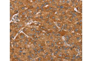 Immunohistochemistry (IHC) image for anti-P Antigen Family, Member 5 (Prostate Associated) (PAGE5) antibody (ABIN2423933) (PAGE5 anticorps)