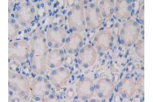 DAB staining on IHC-P; Samples: Mouse Kidney Tissue (NEXN anticorps  (AA 421-607))