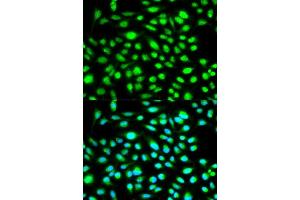 Immunofluorescence (IF) image for anti-Cyclin H (CCNH) (AA 1-323) antibody (ABIN3021259) (Cyclin H anticorps  (AA 1-323))