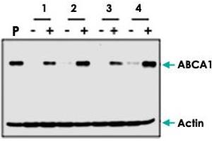 Western blot analysis of ABCA1 induction by cholesterol (+) in human fibroblast cells from different patients (1, 2, 3, 4). (ABCA1 anticorps  (AA 1800-2260))