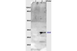 Lane 1: myeloma cell s/p20 lysates Lane 2: mouse brain lysates probed with Anti OTX1 + OTX2 Polyclonal Antibody, Unconjugated (ABIN1387702) at 1:200 in 4 °C. (Otx1 + Otx2 (AA 21-120) anticorps)