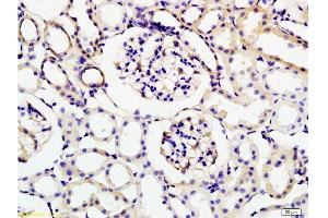 Formalin-fixed and rat kidney tissue labeled with Anti-KLK1 Polyclonal Antibody , Unconjugated at 1:200 followed by conjugation to the secondary antibody and DAB staining