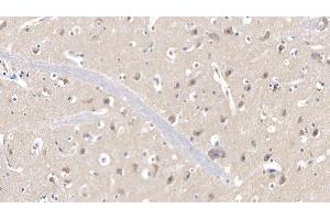 Detection of CDK1 in Human Cerebrum Tissue using Polyclonal Antibody to Cyclin Dependent Kinase 1 (CDK1) (CDK1 anticorps  (AA 59-182))