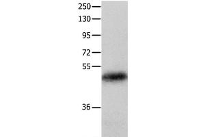 Western Blot analysis of Human colon cancer tissue using KRT23 Polyclonal Antibody at dilution of 1:100