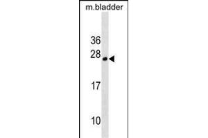 TPD52L1 Antibody (N-term) (ABIN1539373 and ABIN2850189) western blot analysis in mouse bladder tissue lysates (35 μg/lane). (TPD52L1 anticorps  (N-Term))