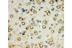 IHC-P: XRCC3 antibody testing of rat brain tissue (XRCC3 anticorps  (C-Term))